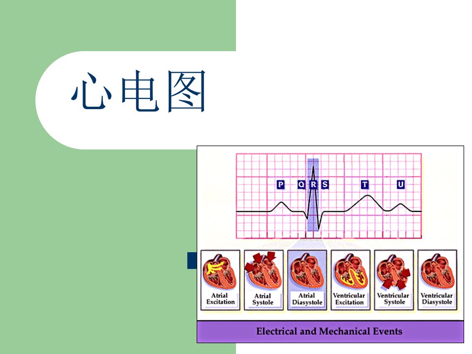 心电图ppt培训课件
