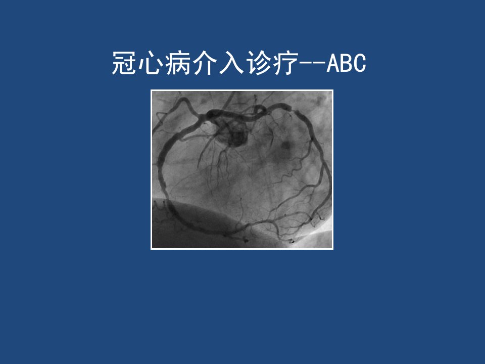 《冠状动脉造影ab》PPT课件