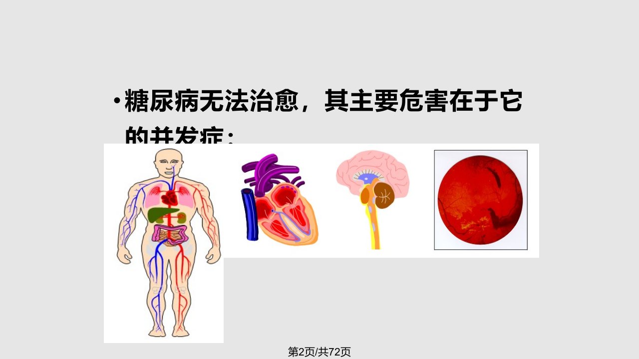 饮食运动治疗糖尿病