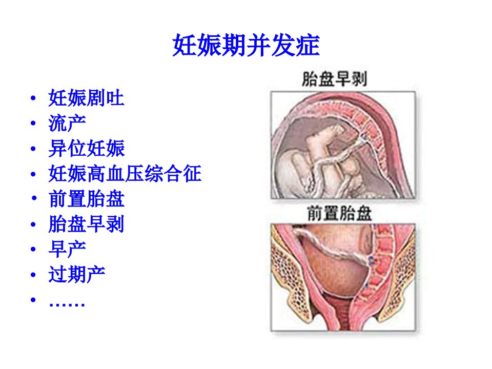 医学专题妊娠合并症并发症处理