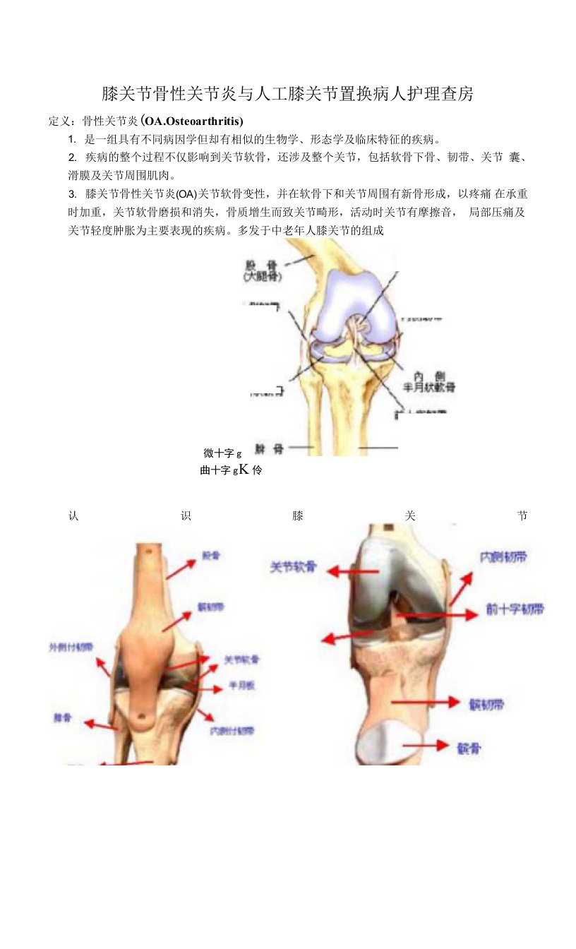 膝关节骨性关节炎和人工置换术的护理查房