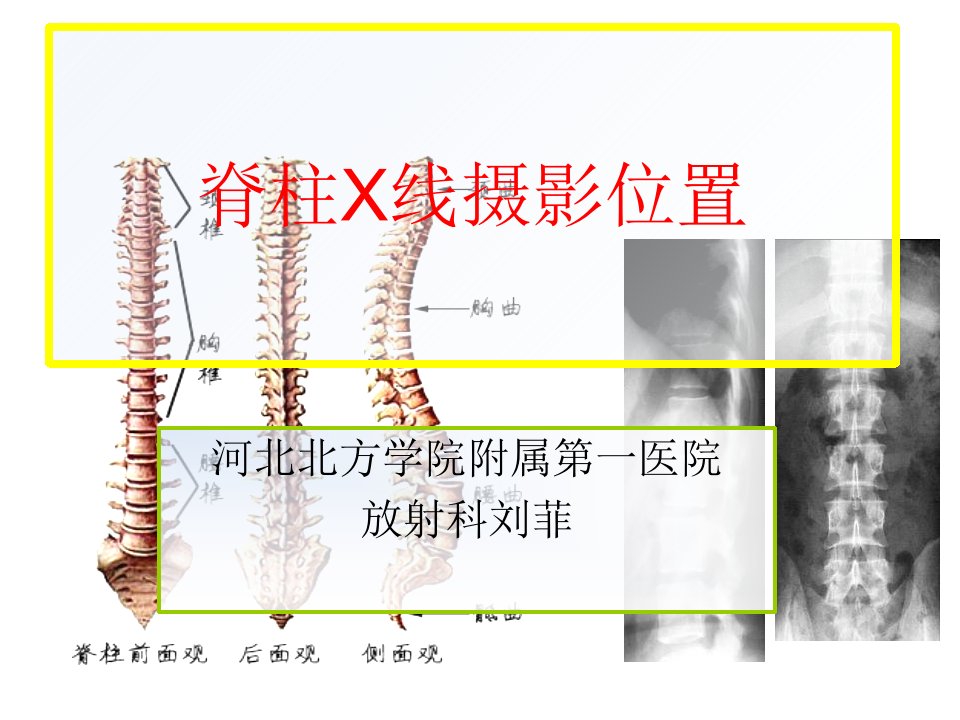 脊柱X线摄影技术