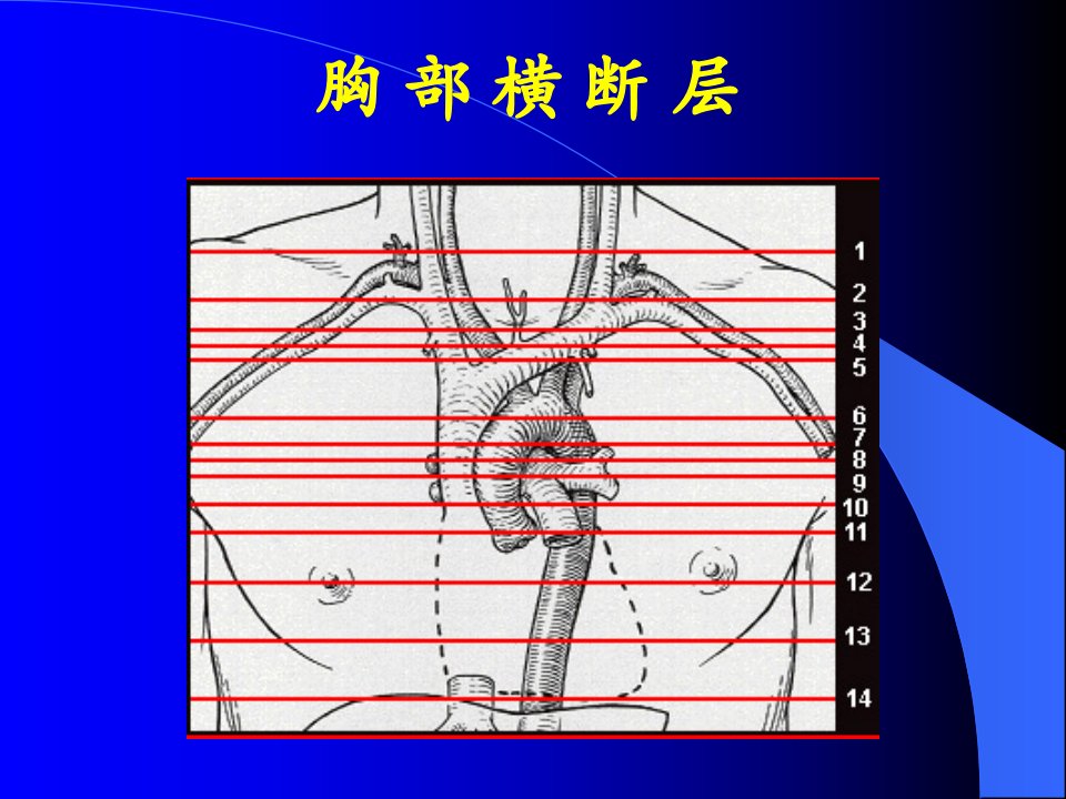 《胸部横断层B学院》PPT课件