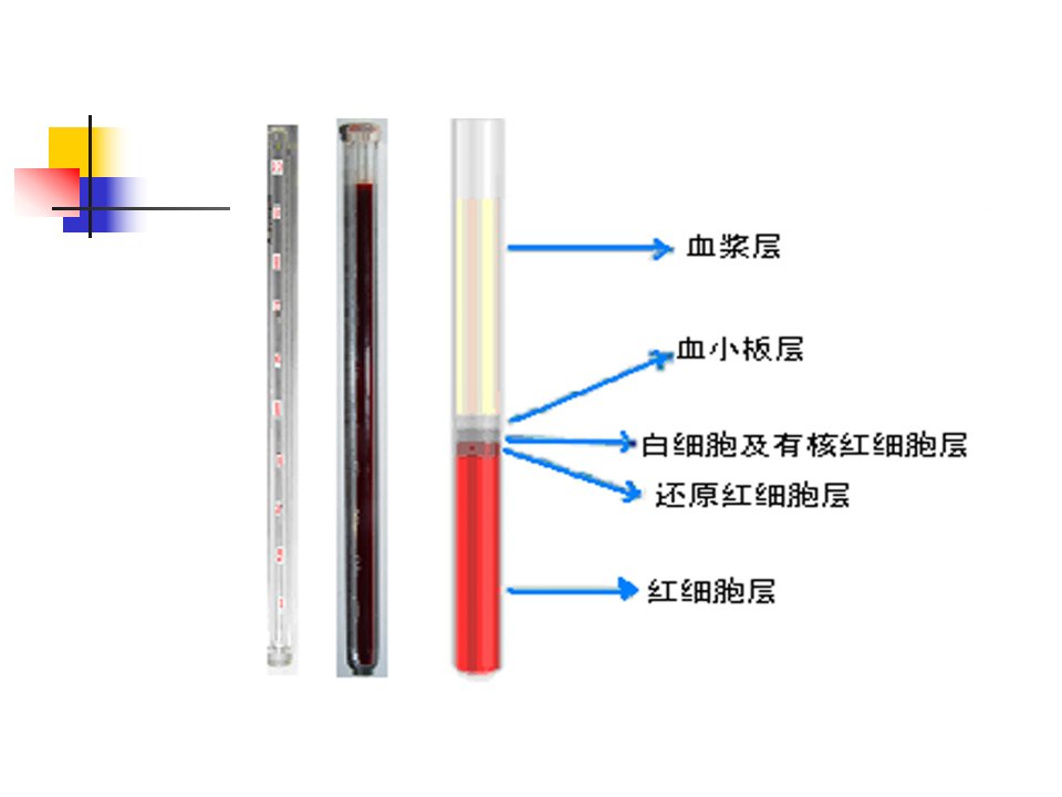 医学专题血液一般检验