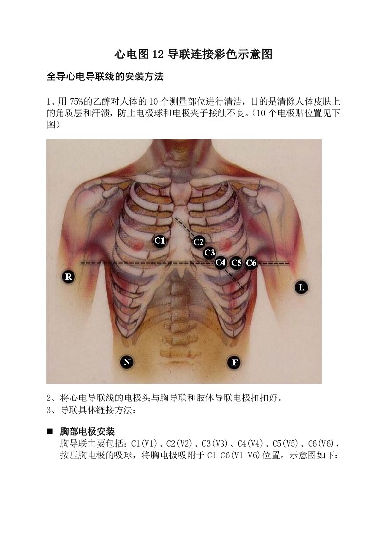 心电图12导联连接彩色示意图