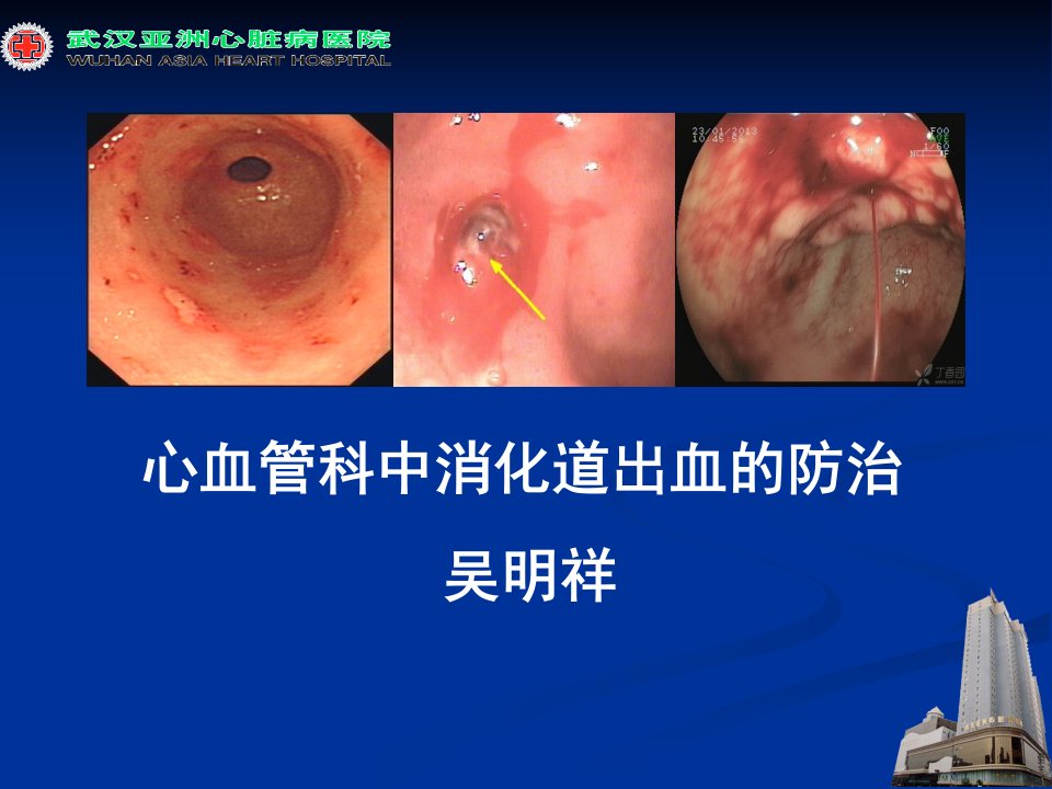 心血管疾病中消化道出血的防治ppt课件