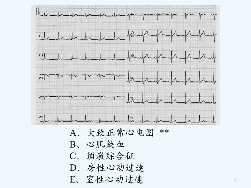 临床技能考试辅助检查结果判读