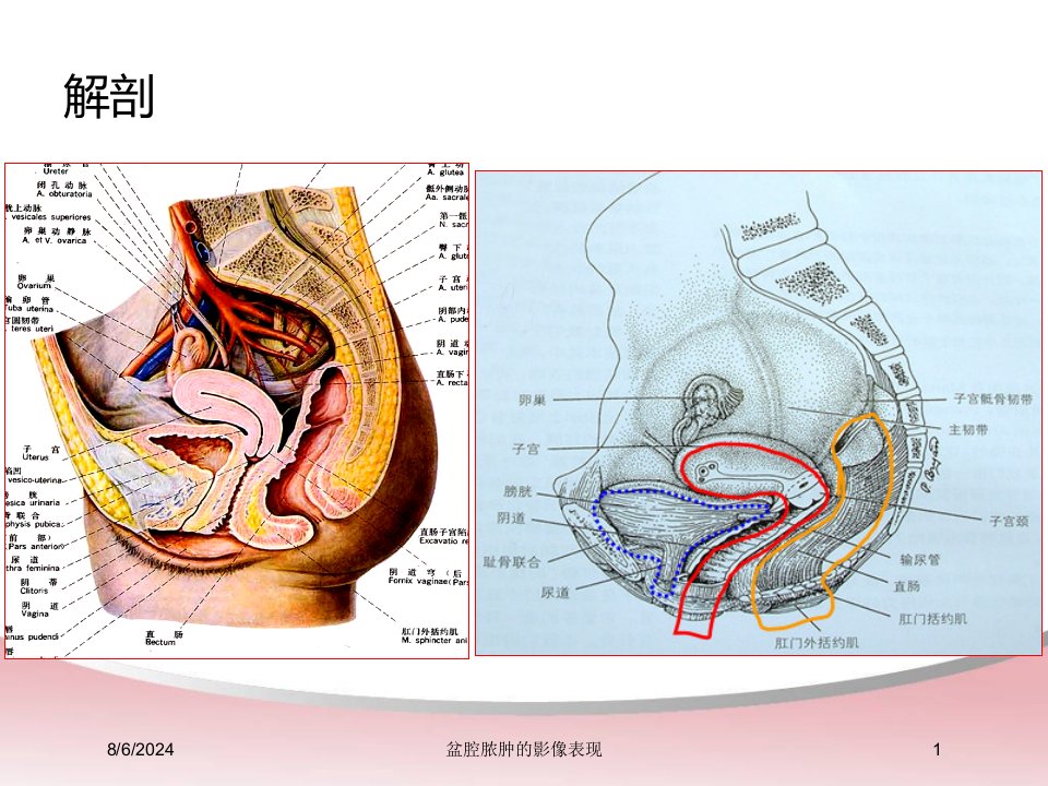 2021年盆腔脓肿的影像表现