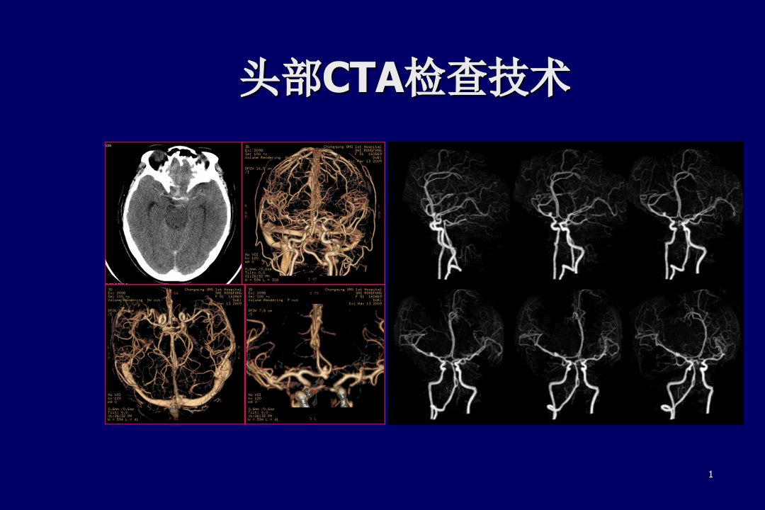 头部CTA检查技术ppt课件