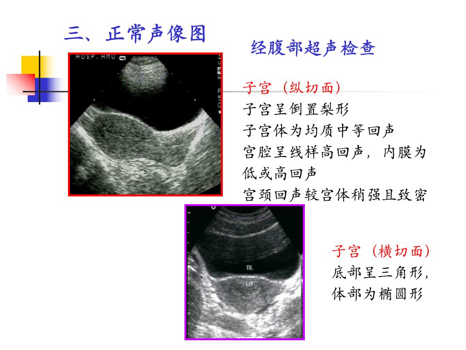 最新安医大本硕妇产科疾病的超声诊断2PPT课件