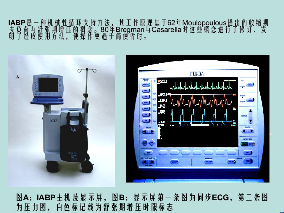 IABP安贞医院的讲义