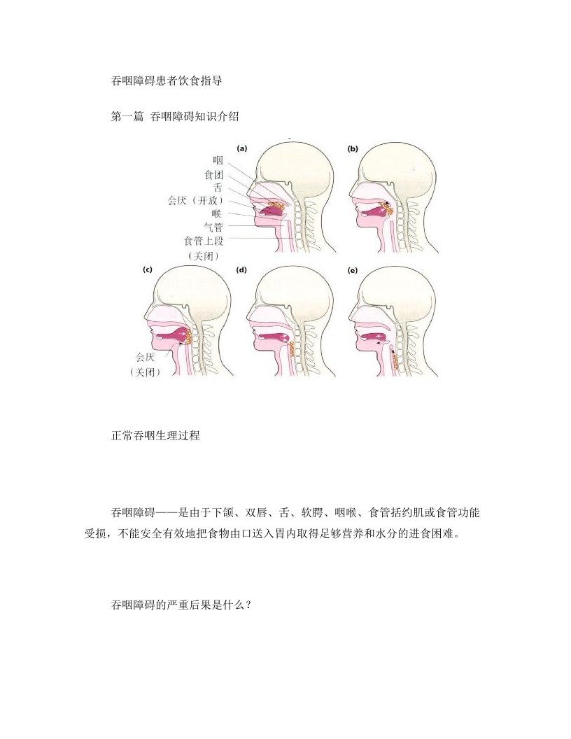 吞咽障碍饮食