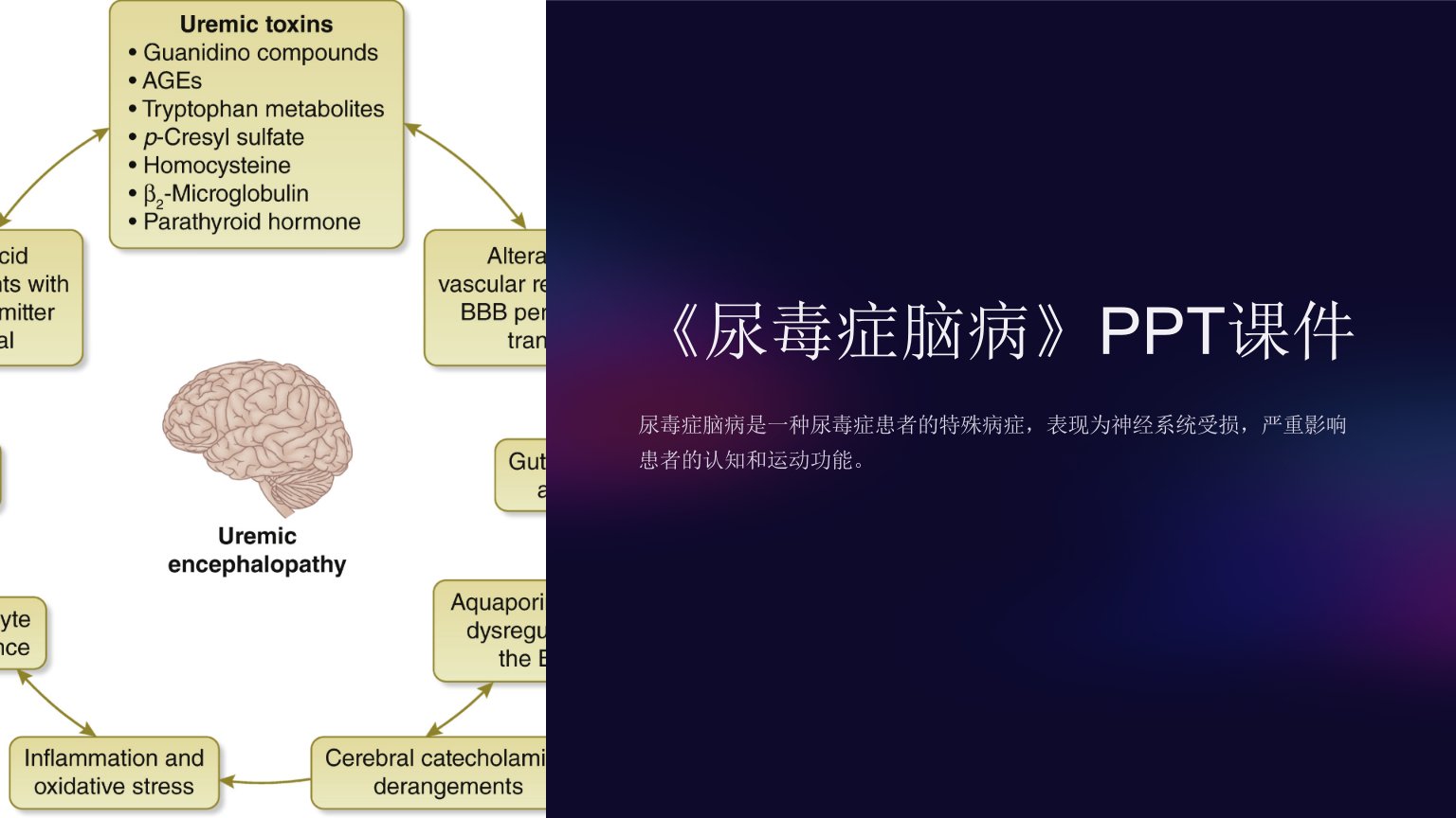 《尿毒症脑病》课件