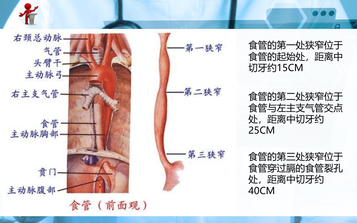 食管癌病人的护理课件