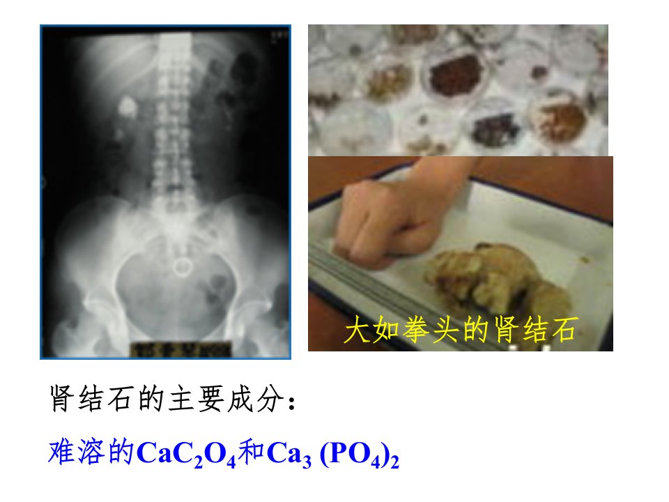 沉淀溶解平衡教学设计