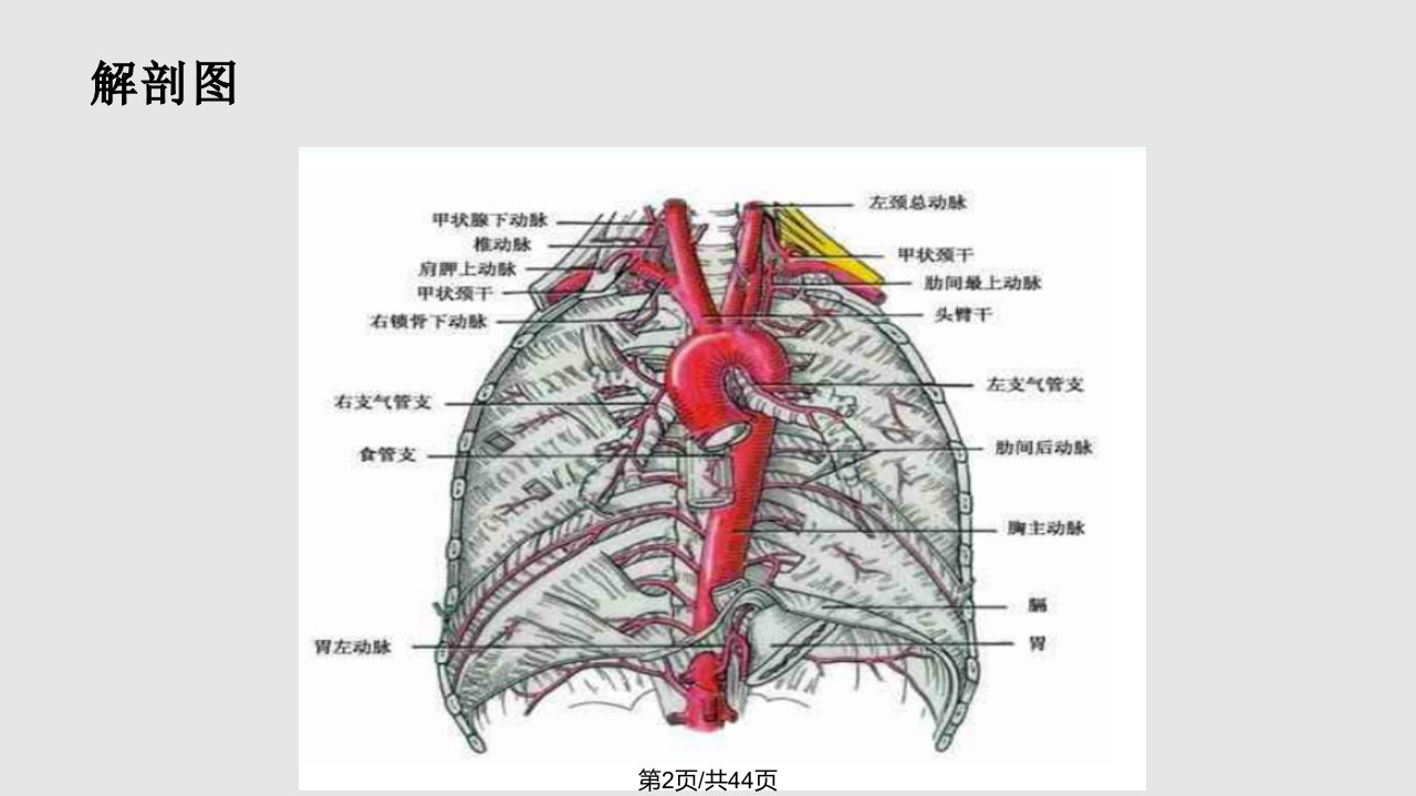 主动脉夹层护理查房1