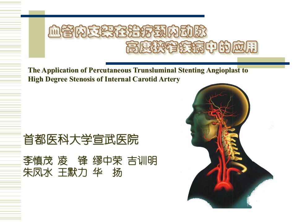 颈动脉支架幻灯片