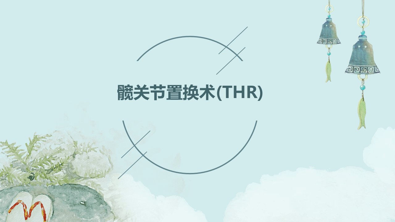 髋关节置换术(THR)