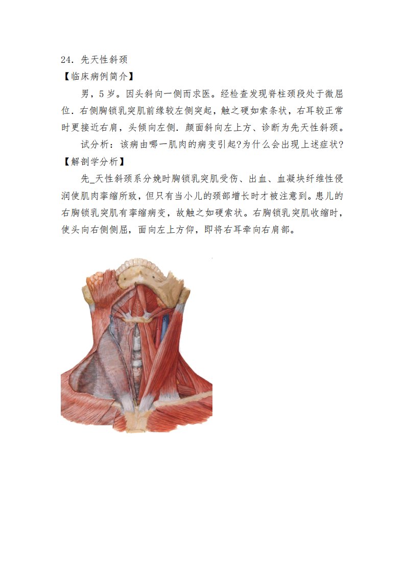 病例24．先天性斜颈