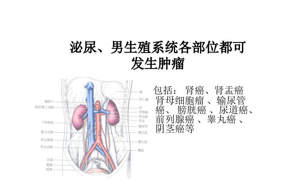 泌尿男生殖系统肿瘤课件