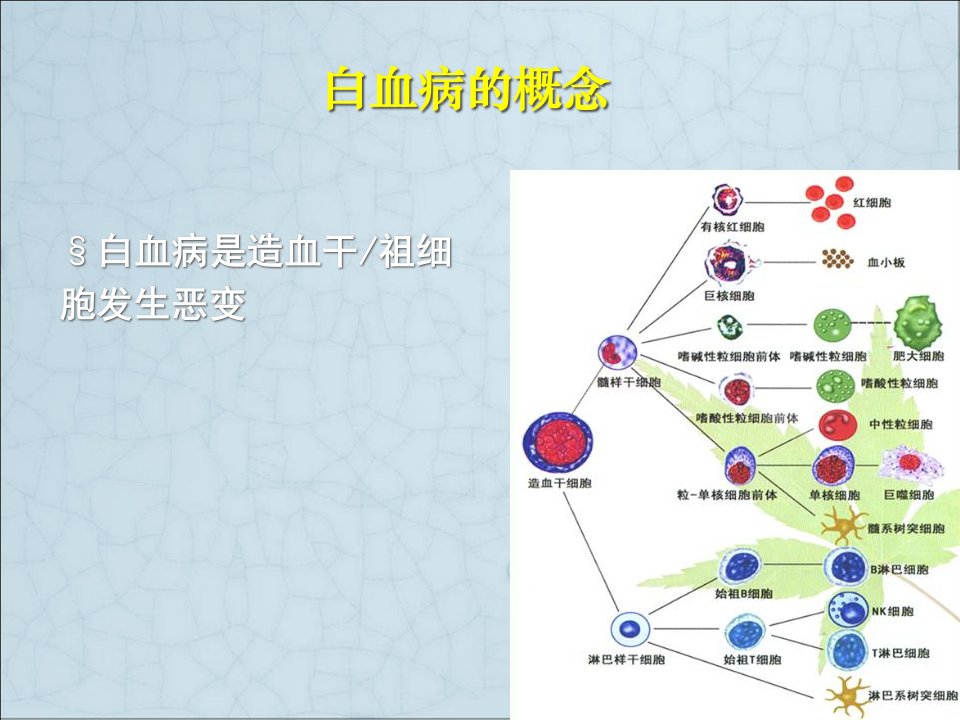 急性白血病的诊断分型和预后Ppt课件