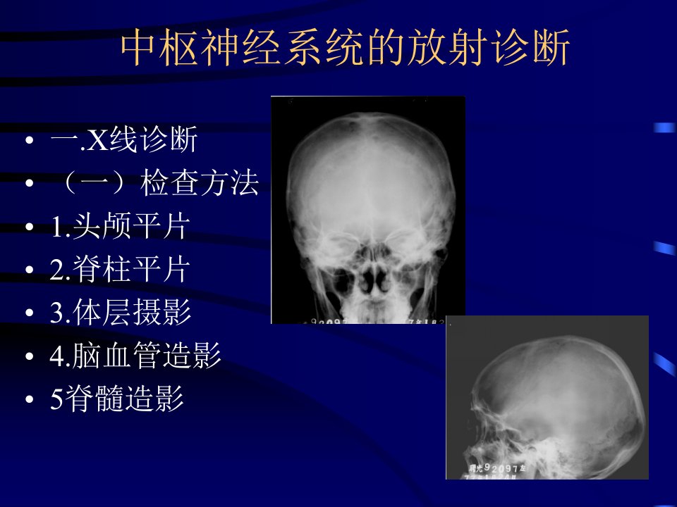 影像诊断神经系统