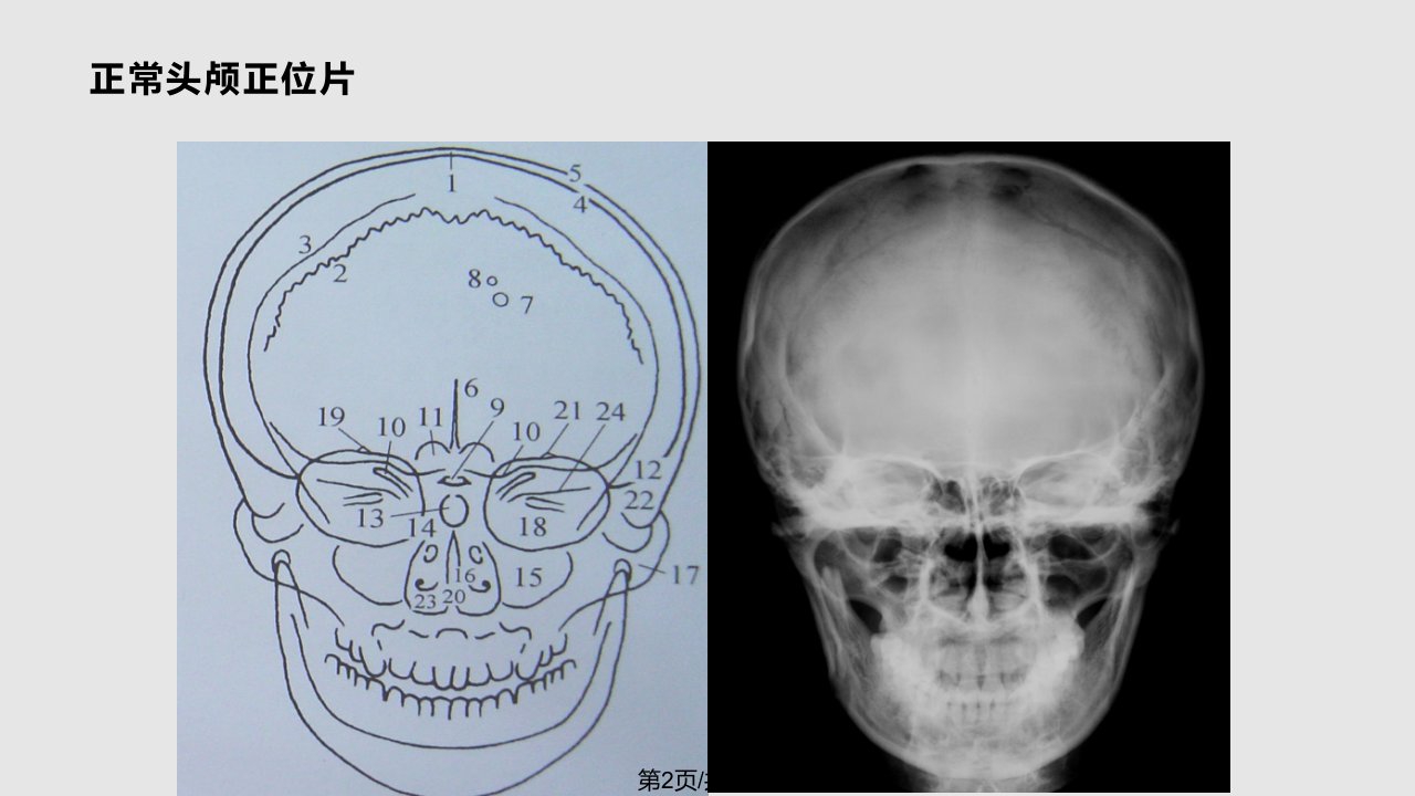 神经系统影像学诊断