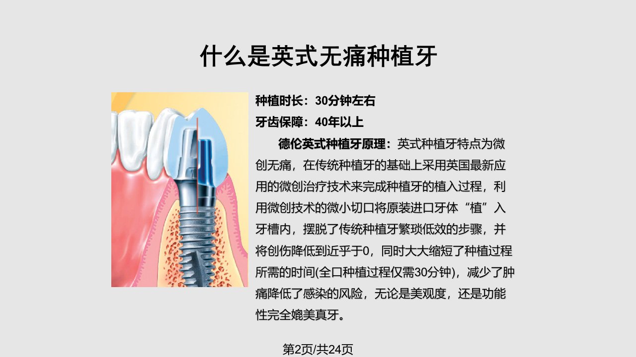 英式无痛种植牙技术讲解