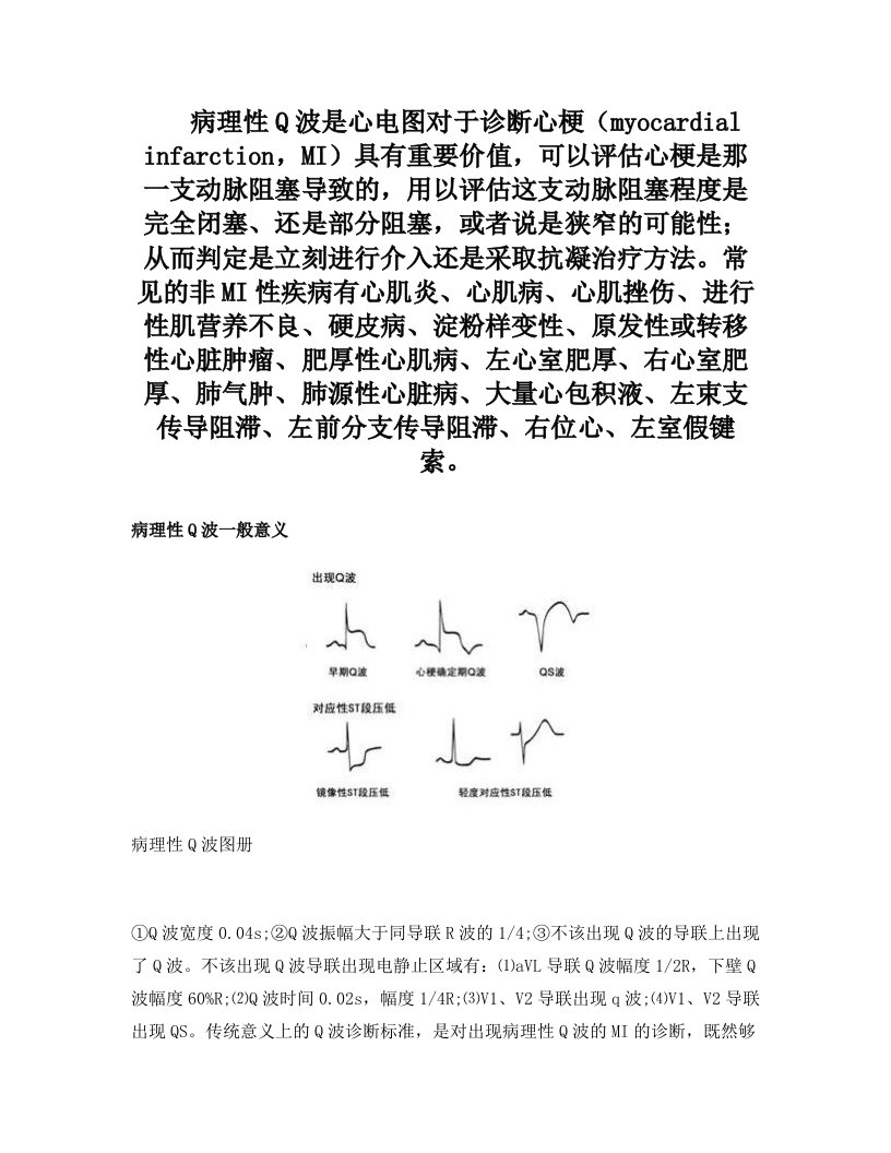 病理性Q波是心电图对于诊断心梗