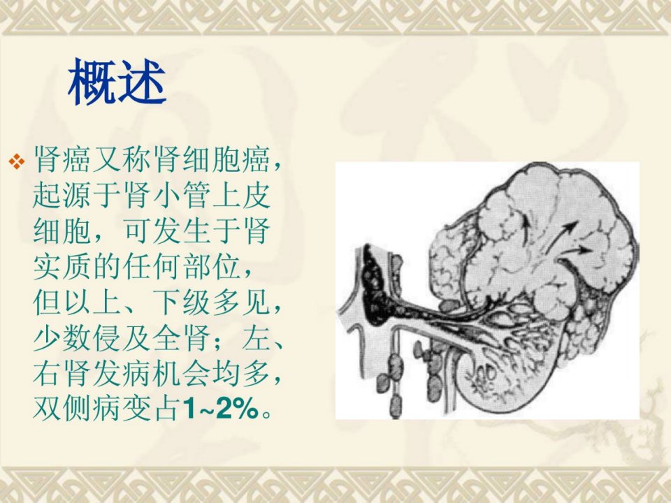 肾癌的治疗与护理