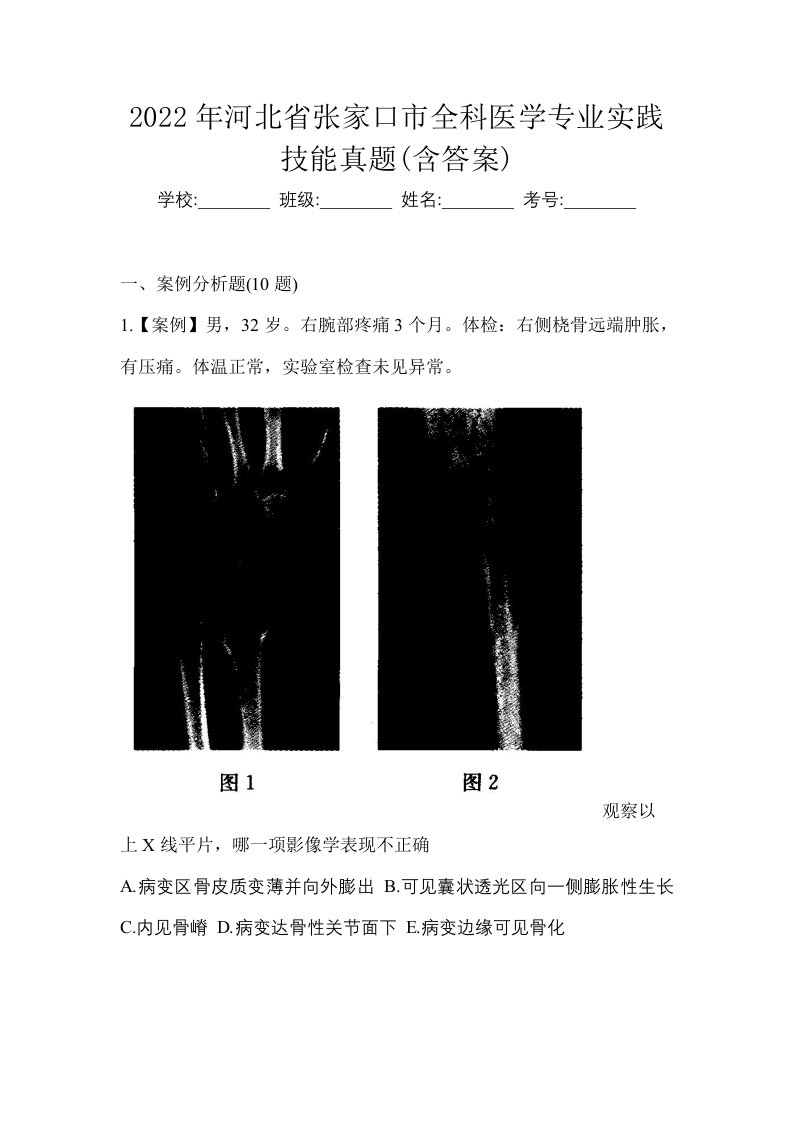 2022年河北省张家口市全科医学专业实践技能真题含答案