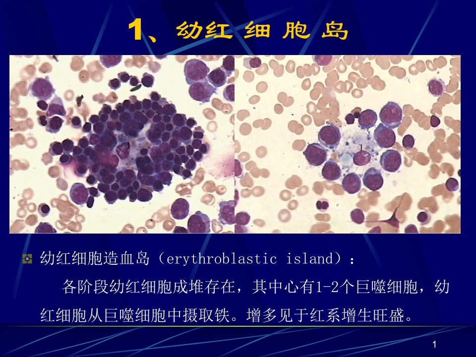 骨髓细胞形态讲解课件