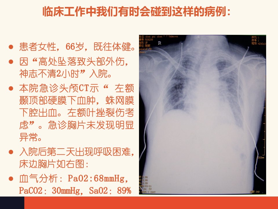 医学专题顽固性低氧血症的诊治策略