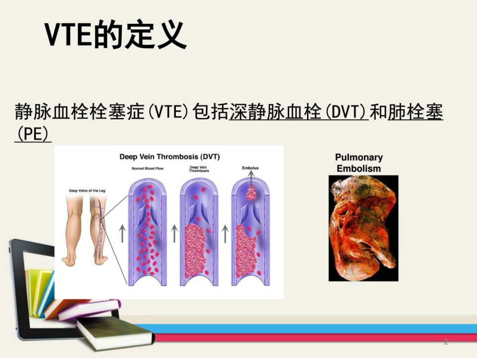 精华静脉血栓的防备及相干指南的解读图文