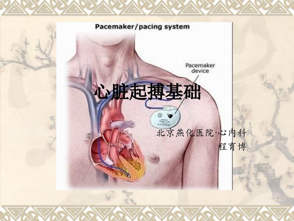 《心脏起搏基础》PPT课件