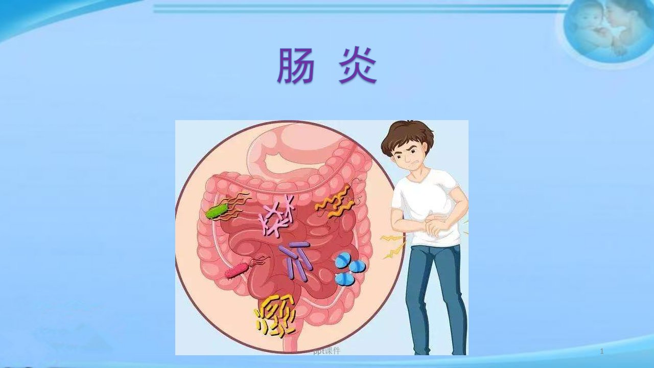 肠炎【消化内科】课件