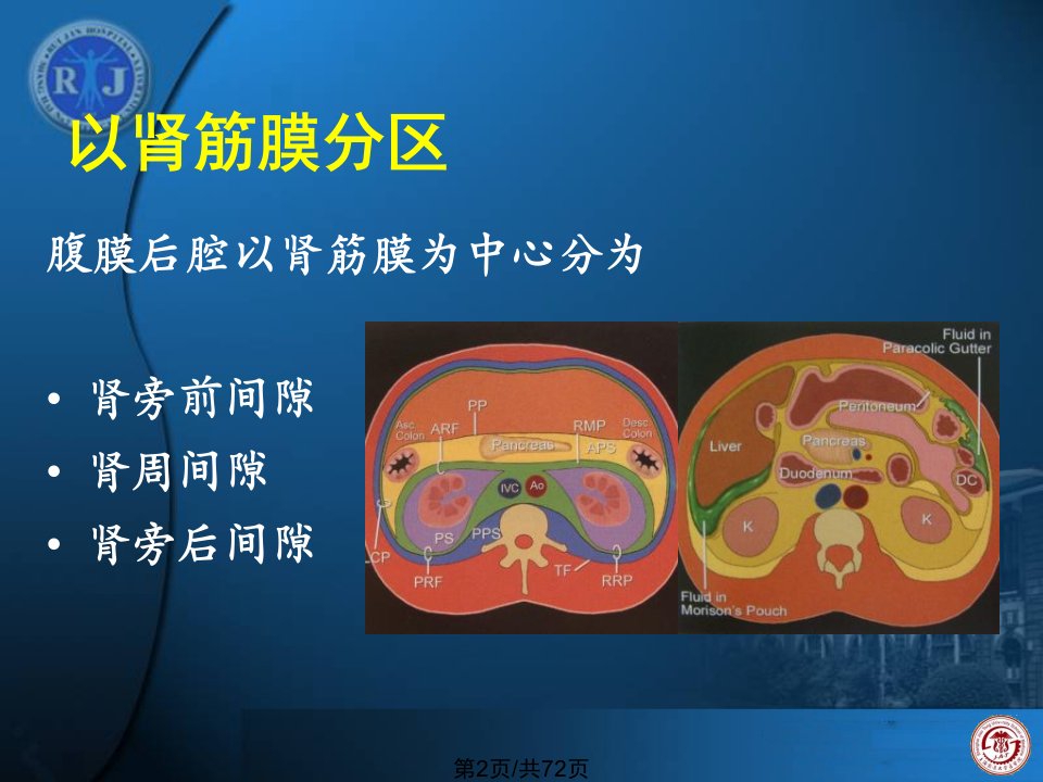 腹膜后病变和淋巴瘤的诊断及活检陈克敏