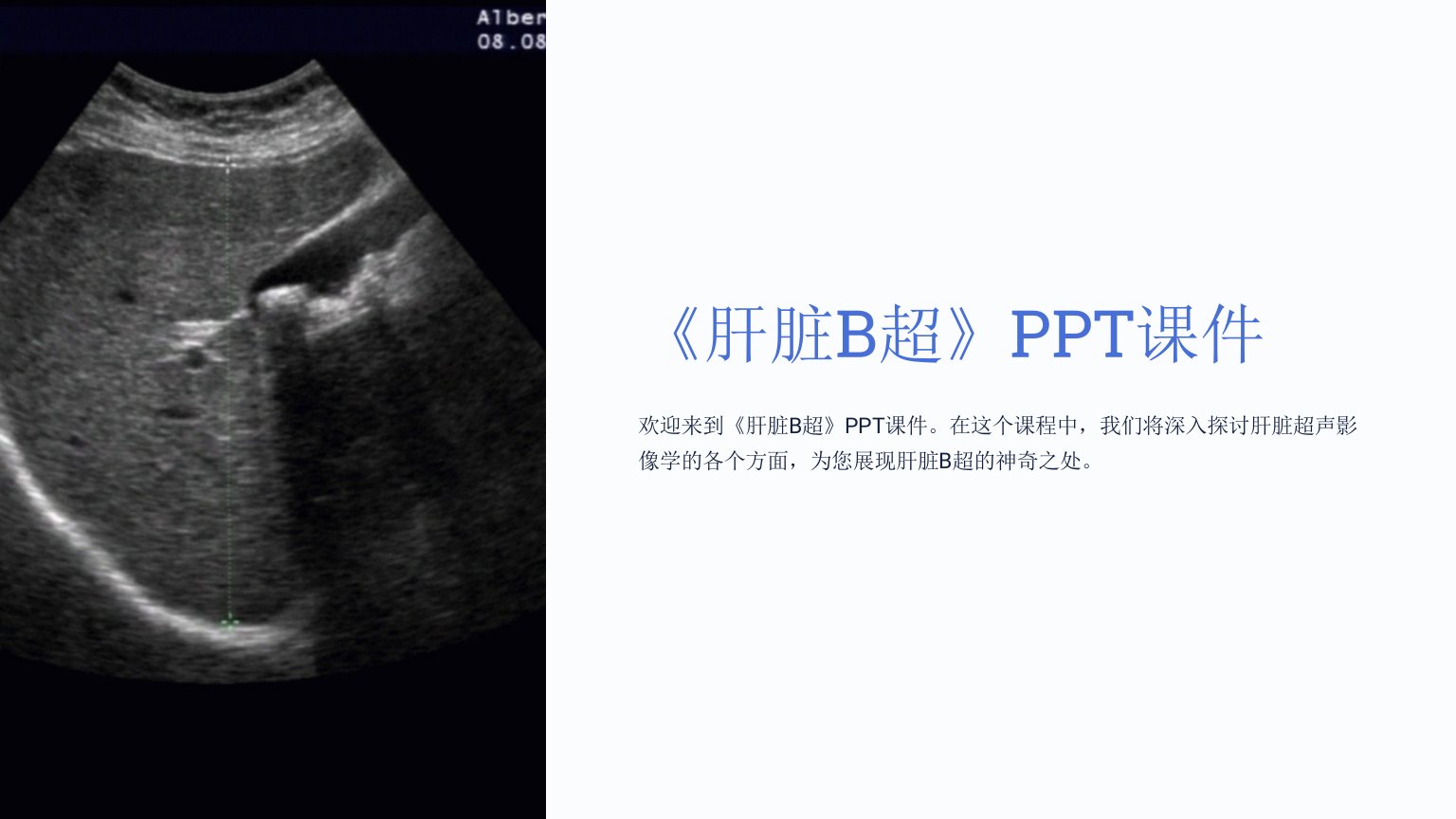 《肝脏B超》课件