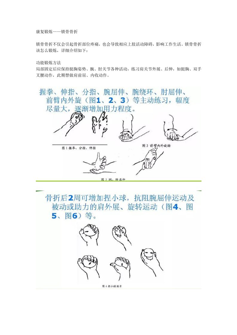 锁骨骨折的康复锻炼方法