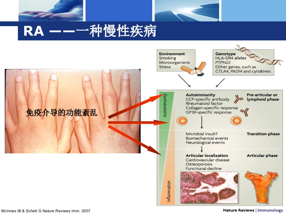 RA和AS的围手术期治疗