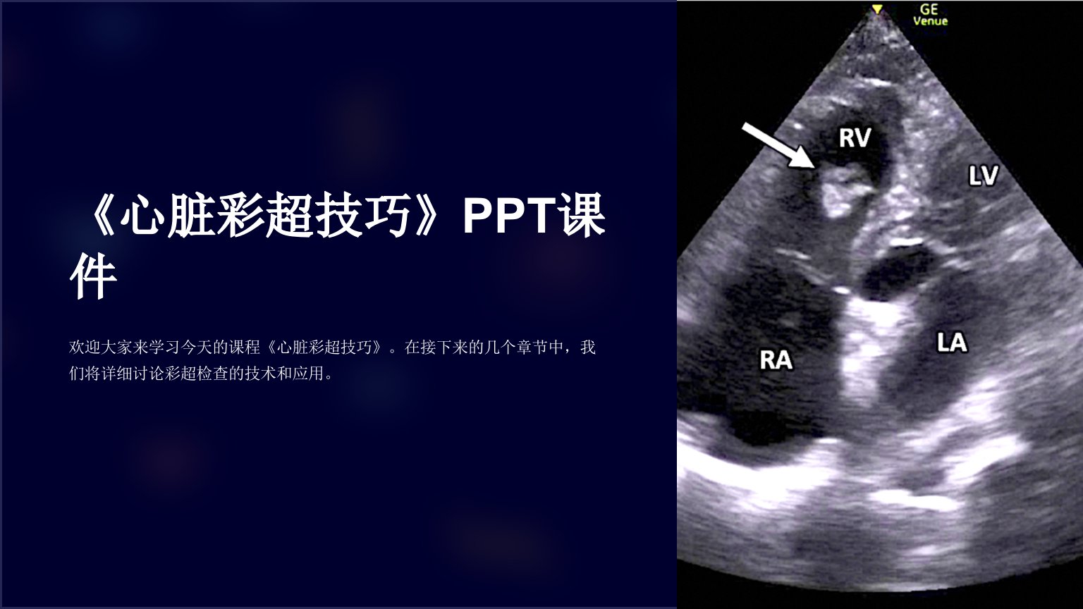 《心脏彩超技巧》课件