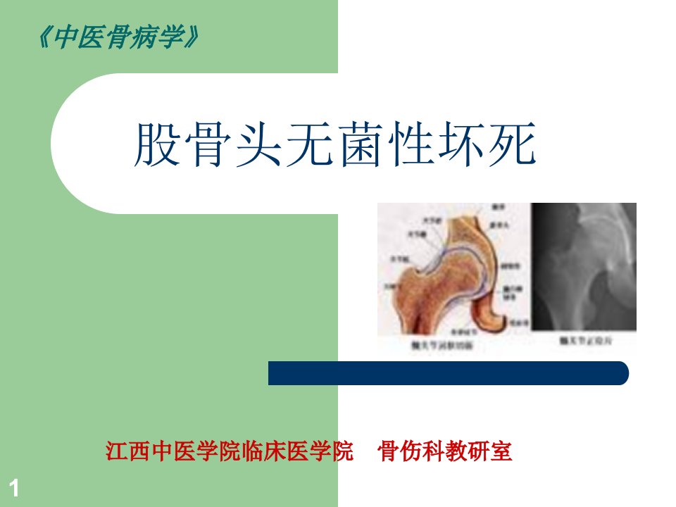 《中西医结合骨伤科学》股骨头坏死ppt课件