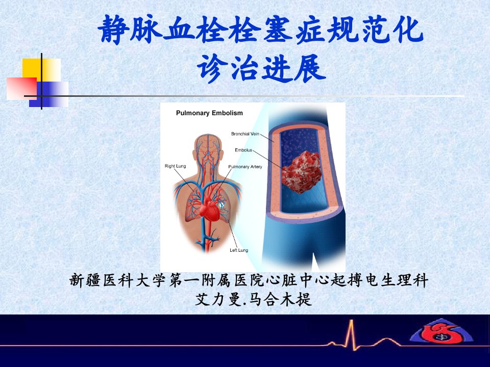 区级VTE