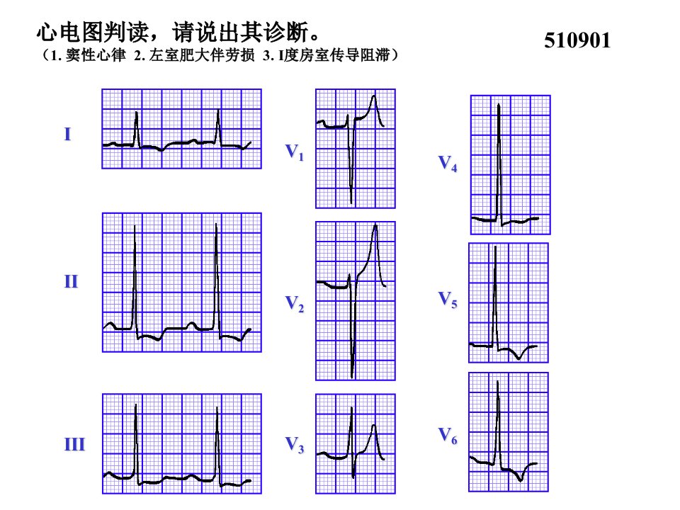 心电图试题及答案