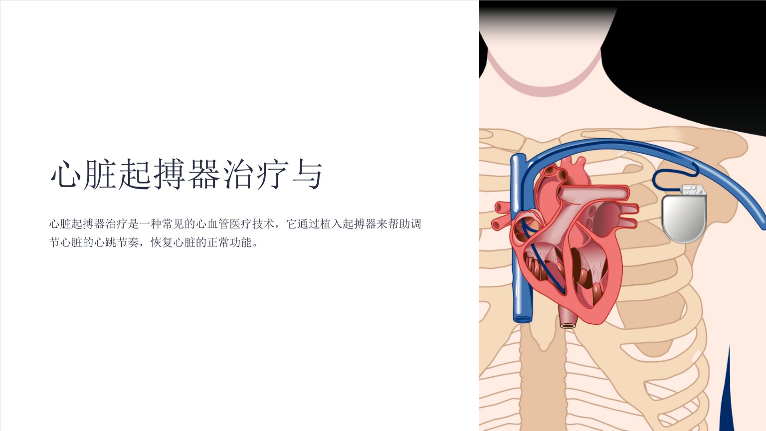 《心脏起搏器治疗与》课件