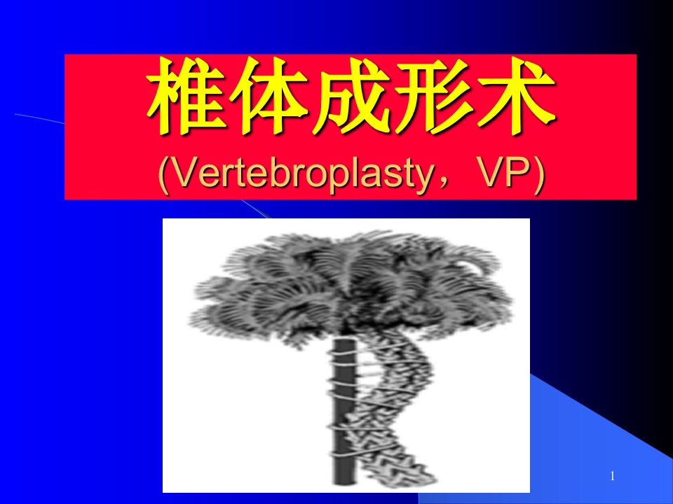 椎体成形术医学ppt课件