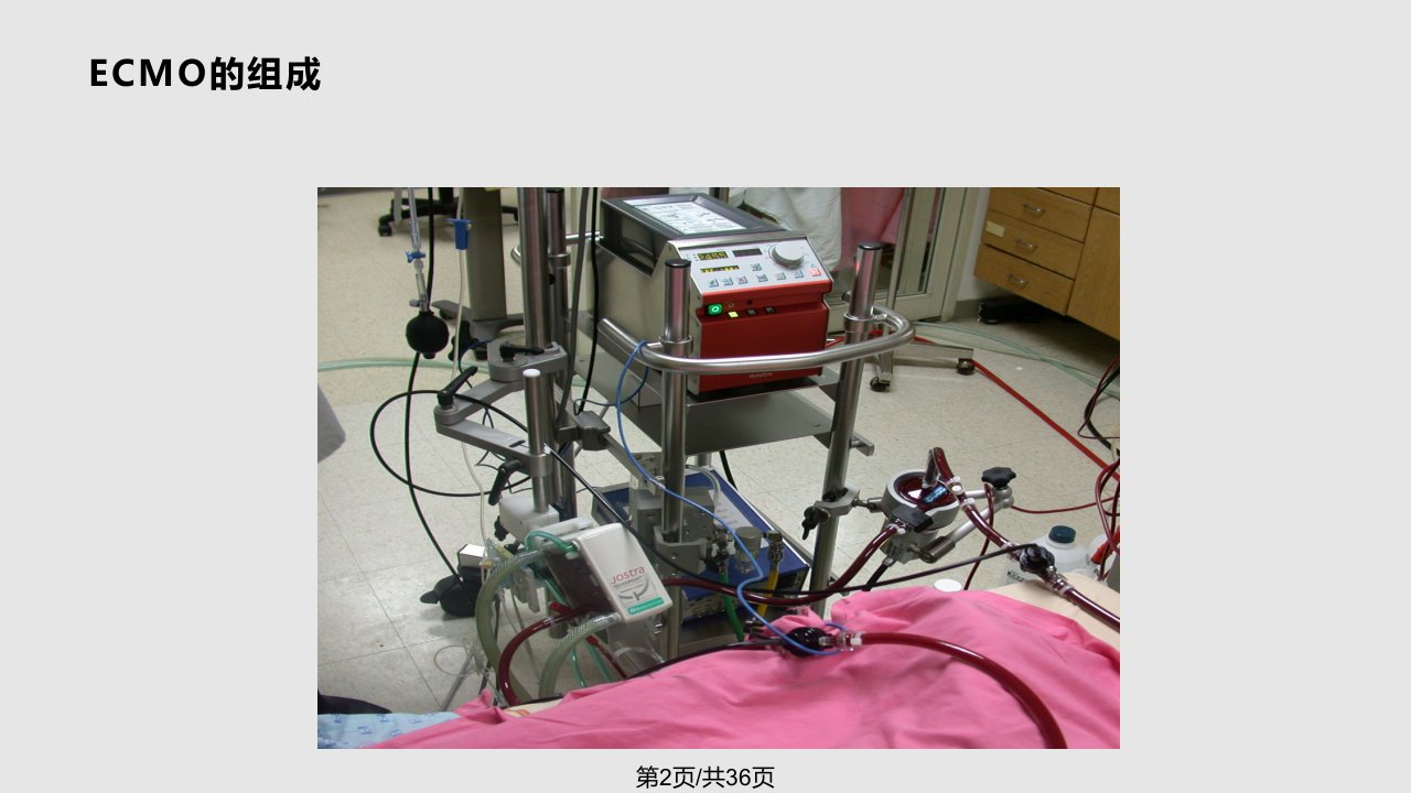 ECMO在危重症中的应用