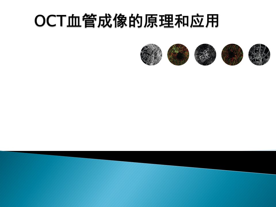 OCT血管成像的原理和应用ppt课件