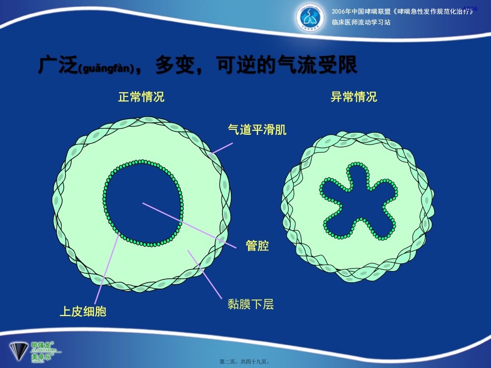 医学专题支气管扩张剂在支气管哮喘急性发作时的应用