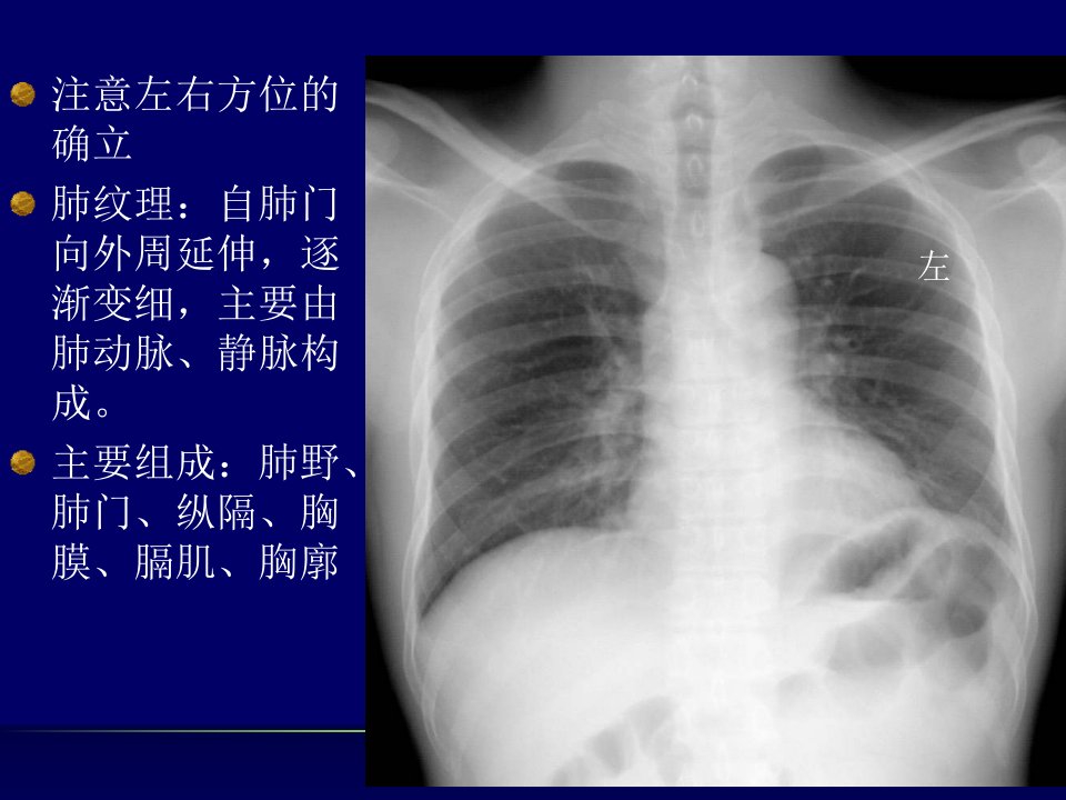 执业医师培训-南方医院-放射诊断学培训材料PPT课件